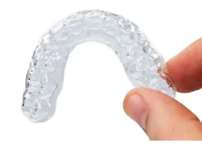 Allineatori dentali